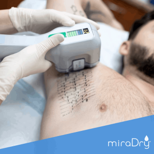 miraDry treatment for excessive sweating