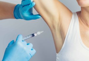 Botox Injections for Underarm Sweating